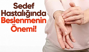 Sedef Hastalığında Beslenmenin Önemi!