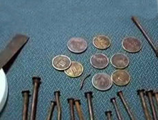 Midesinden 260 Madeni Para Çıktı