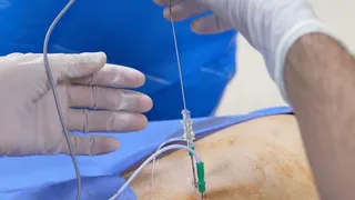 Ağrı tedavisinde yeni uygulama