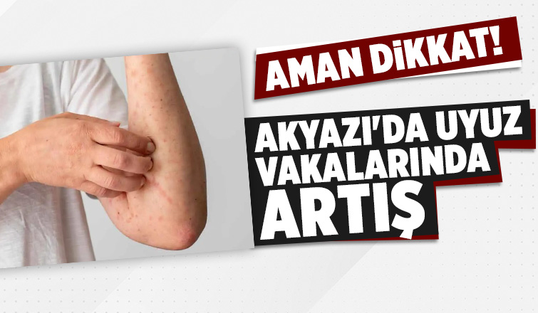 Akyazı'da uyuz vakalarında artış