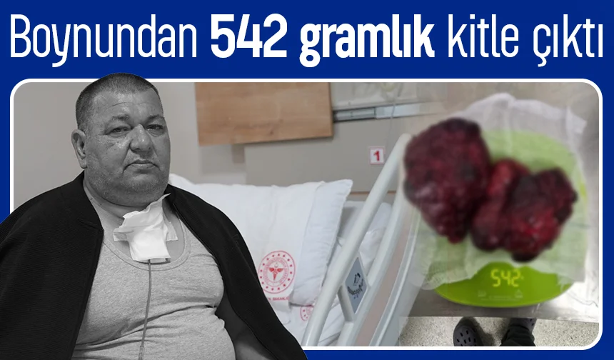 Boynundan 542 gramlık kitle çıktı