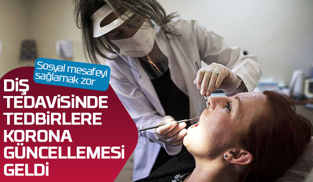 Diş tedavisi sırasında alınacak koronavirüs önlemleri