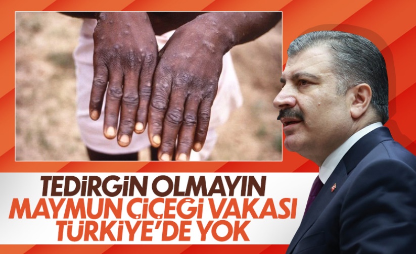Fahrettin Koca: Maymun çiçeği tedirginlik oluşturmamalı