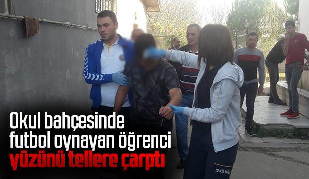 Futbol Oynarken Yüzünü Tellere Çarptı