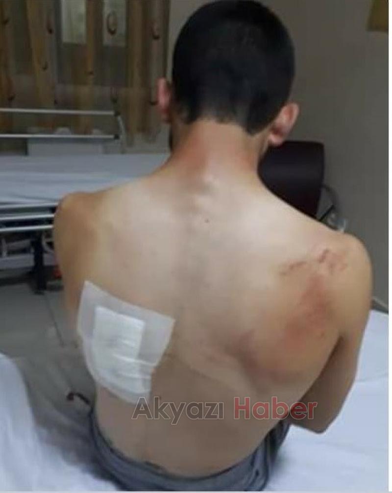 Ayının saldırısından köpekleri kurtardı