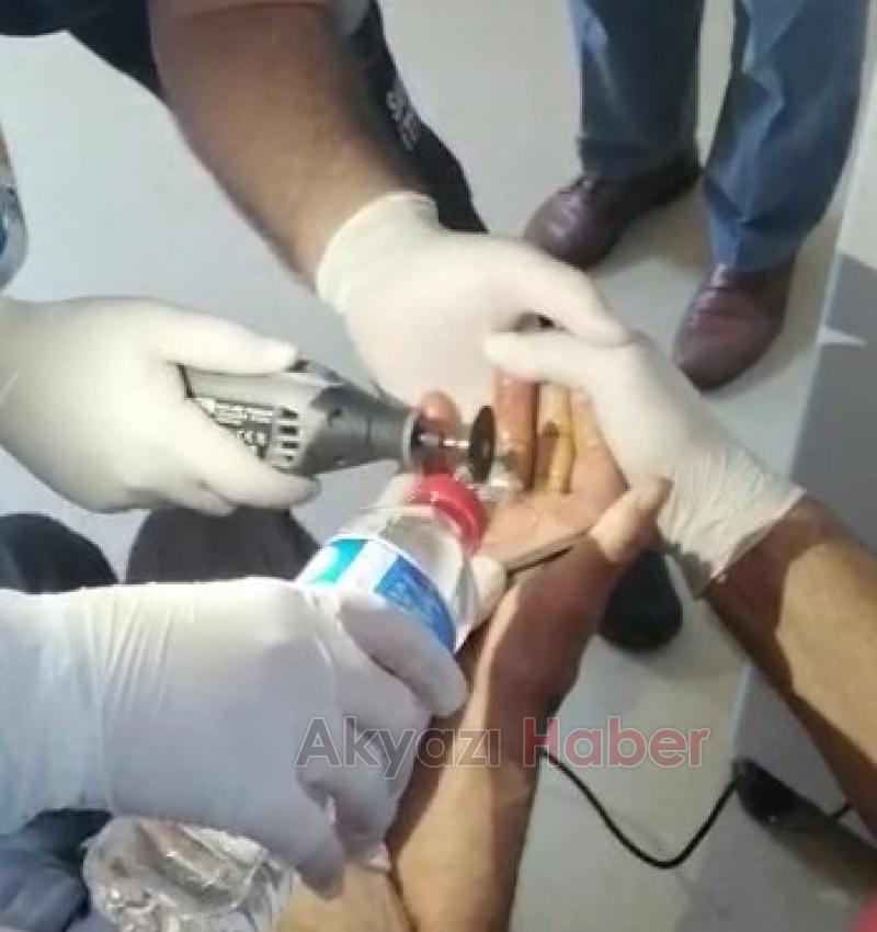 Parmağa sıkışan yüzük kesilerek çıkarıldı