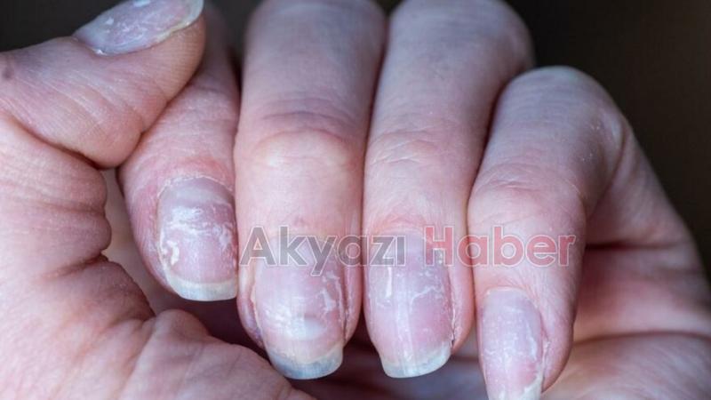 Omicron'un yeni belirtisi ortaya çıktı