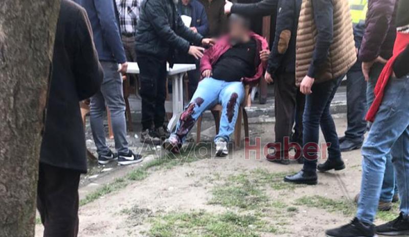 Akyazı da pompalı saldırı 2 yaralı