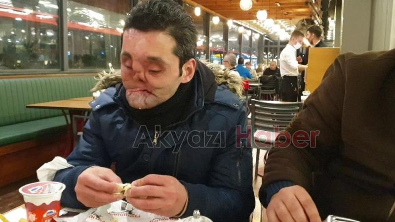 Gözlerini, çenesini ve burnunu kaybeden gencin hayali gerçek olacak