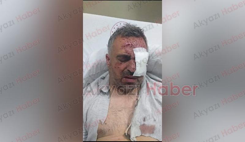 Taksim'deki patlamada yaralılar arasında Akyazılı kuaförde var