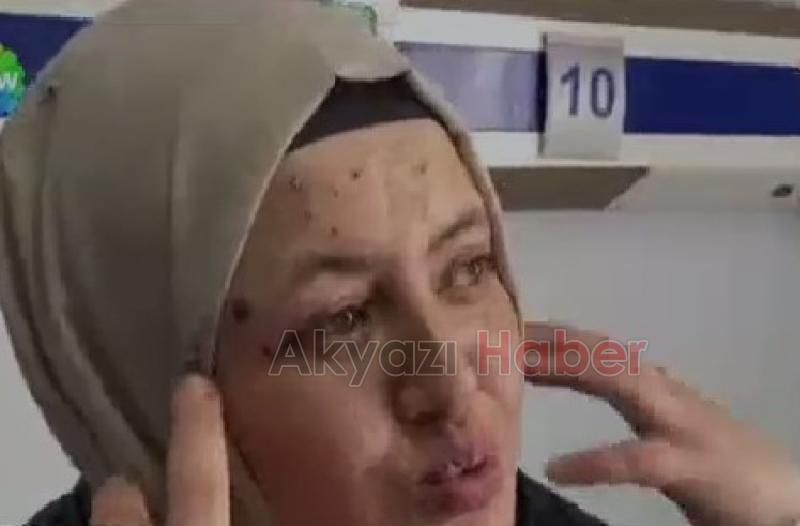 Patlamada yaralanan Akyazılı aile konuştu