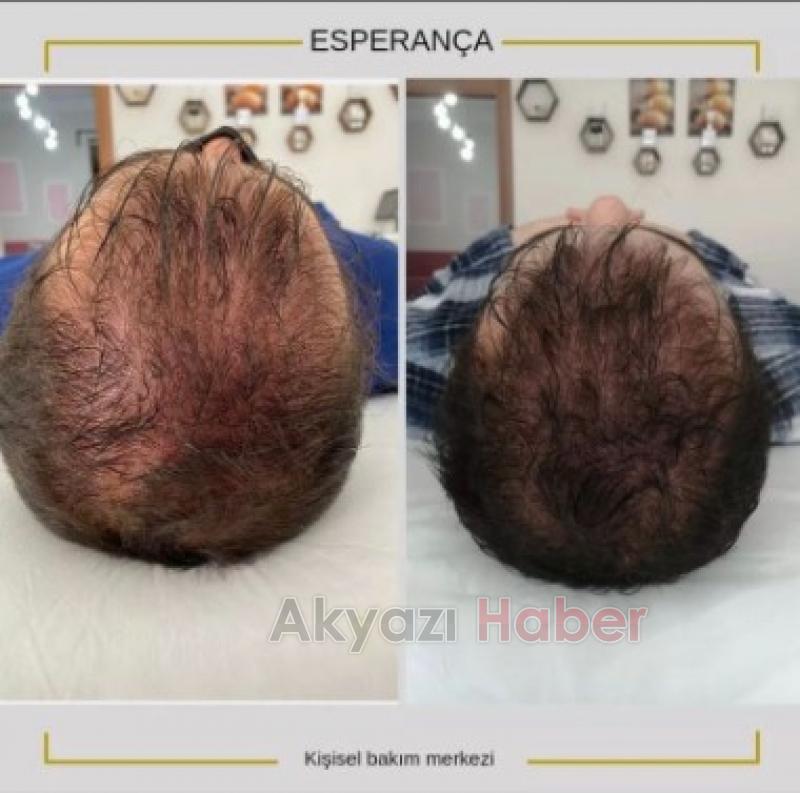 Sonuç garantili kişisel bakım sadece Esperança'da