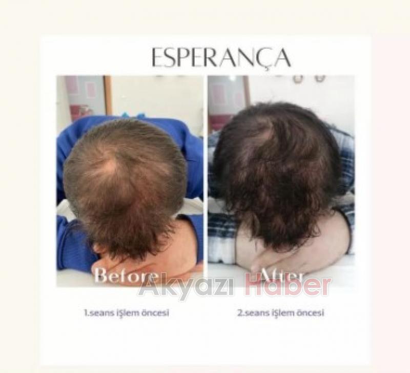 Sonuç garantili kişisel bakım sadece Esperança'da