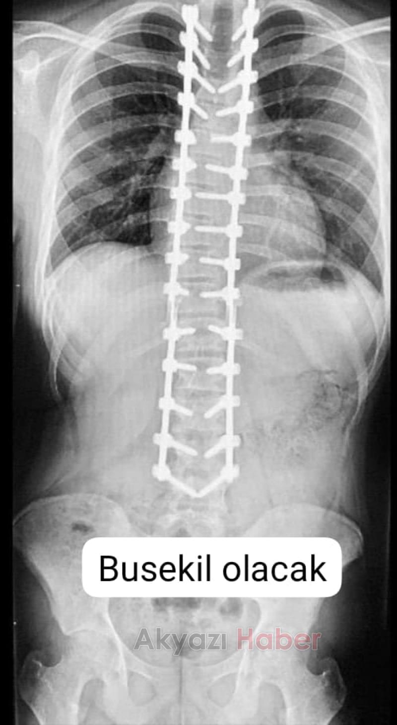 Ameliyat masrafları için yardım çağrısı