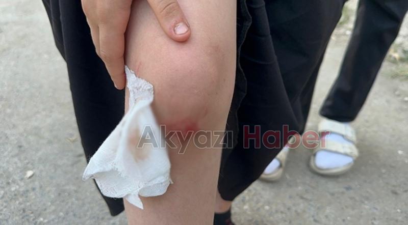 Kız çocuğuna okula giderken köpek saldırıp ısırdı