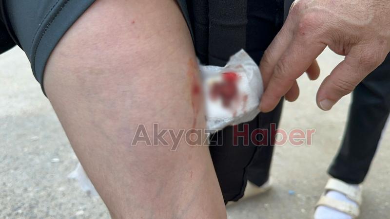 Kız çocuğuna okula giderken köpek saldırıp ısırdı