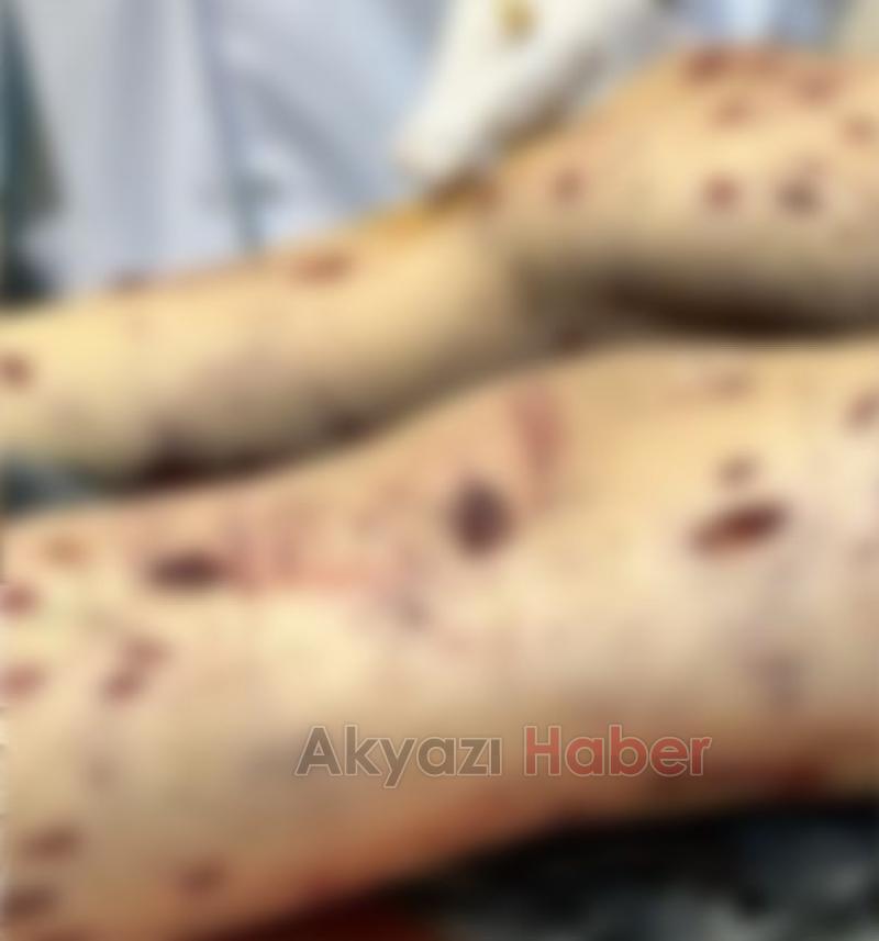 Sokak köpekleri ağır yaralamıştı Tunahan Akyazıdan Ankaraya gitmiş