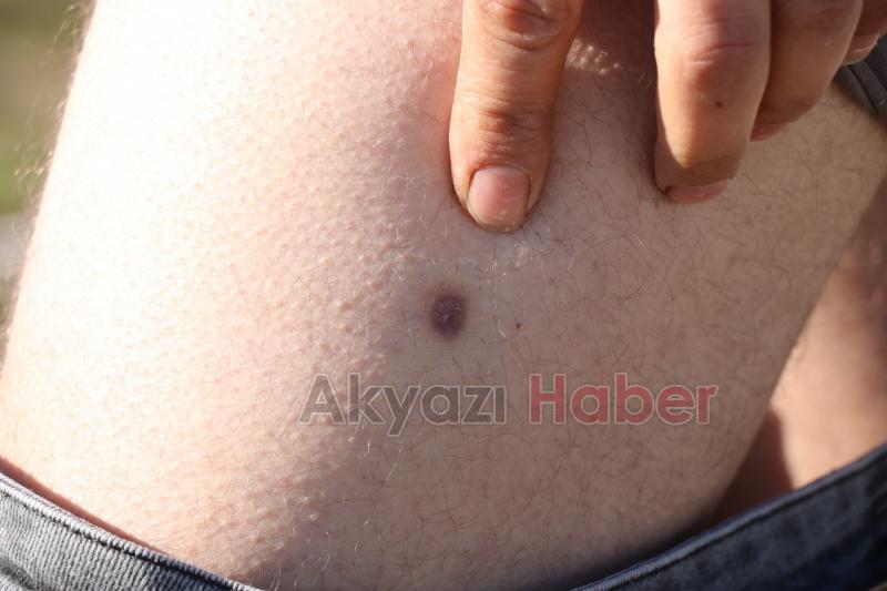 Miras yüzünden kardeşini vurdu: işte o anlar