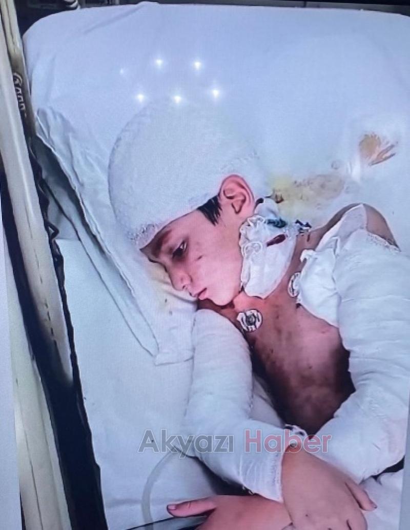 Köpeklerin saldırısına uğrayan Tunahan yoğun bakımdan çıktı