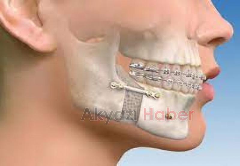 Çene bölgenizde ağrı mı hissediyorsunuz?