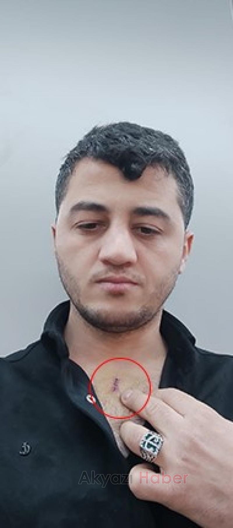 Akyazılı iş adamı yardım ettiği kişi tarafından bıçaklandı