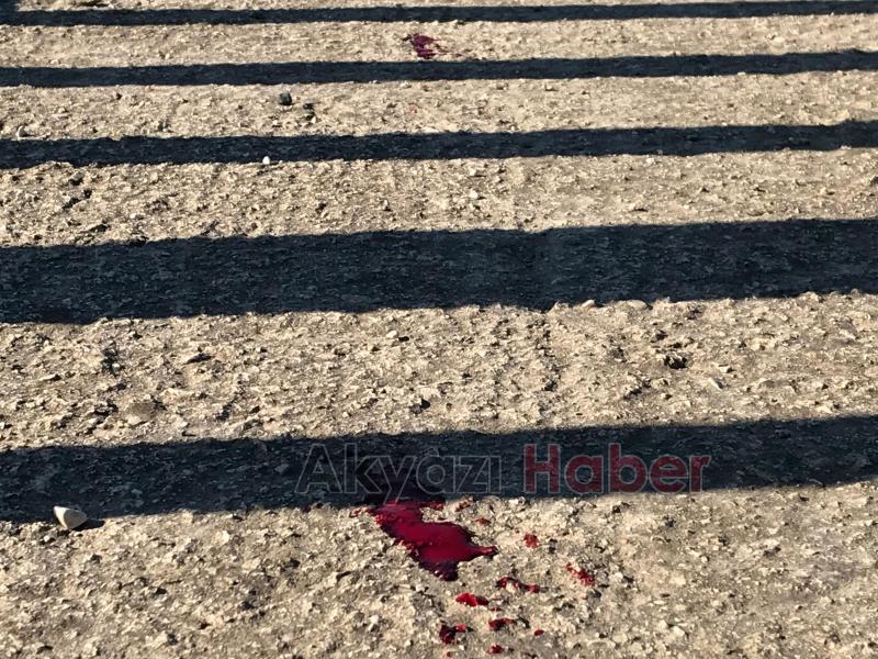 Arbede sırasında silah ateş adlı vuruldu