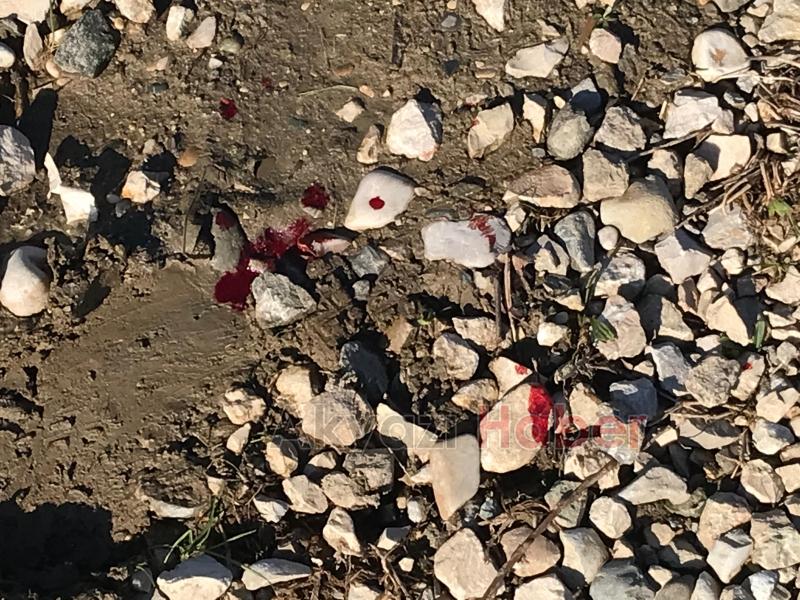 Arbede sırasında silah ateş adlı vuruldu