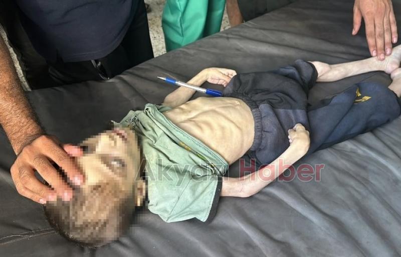 Gazze'de bir çocuk daha açlıktan öldü