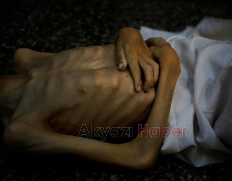 Gazze'de insanlık ayıbı: Bir çocuk daha açlıktan öldü
