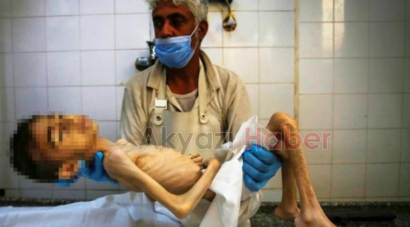 Gazze'de insanlık ayıbı: Bir çocuk daha açlıktan öldü