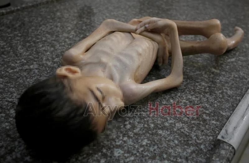 Gazze'de insanlık ayıbı: Bir çocuk daha açlıktan öldü
