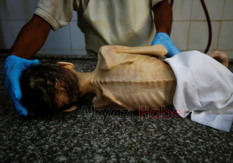 Gazze'de insanlık ayıbı: Bir çocuk daha açlıktan öldü