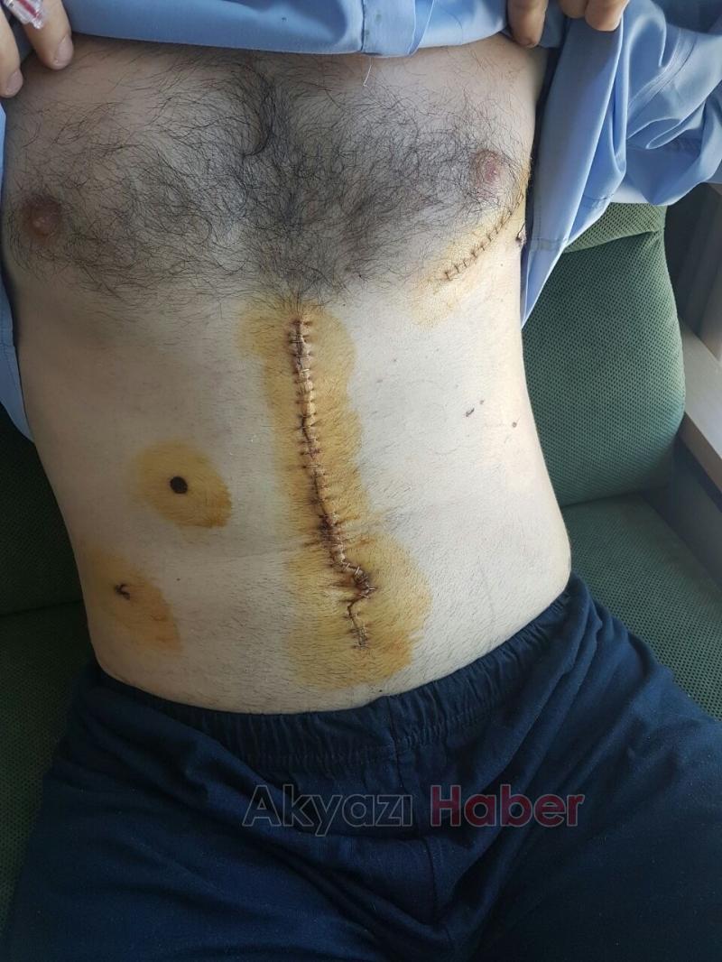 15 Temmuz gazisi o karanlık geceyi anlattı