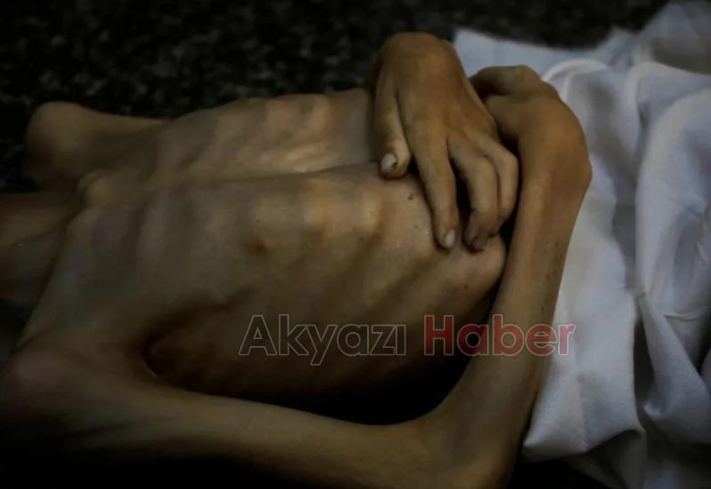 Gazze'de 11 aylık acı tablo 16 bin 480 çocuk İsrail saldırısında öldü