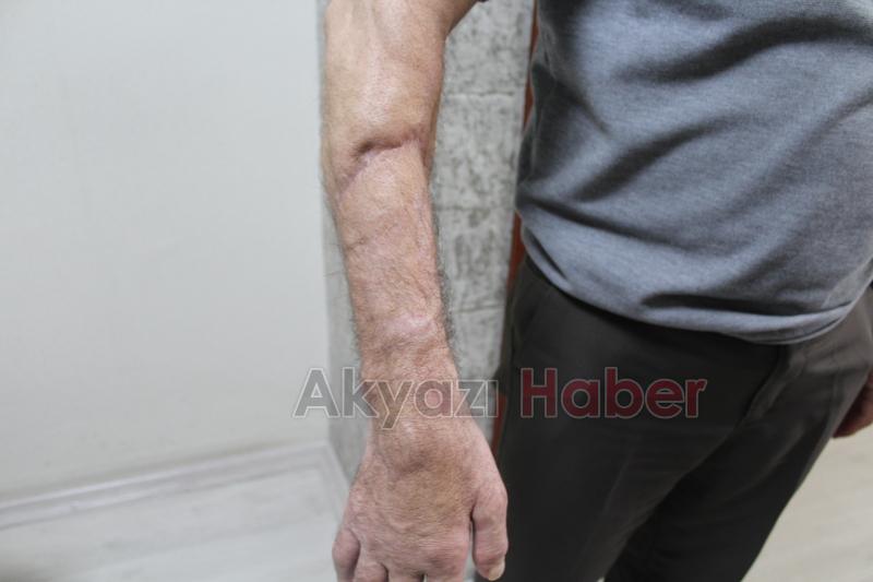 SEAH’ta iki başarılı ameliyatla kopan uzuvlar kurtarıldı