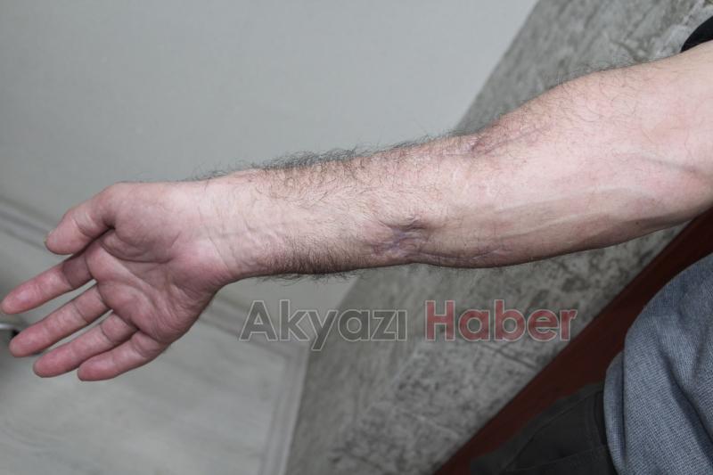 SEAH’ta iki başarılı ameliyatla kopan uzuvlar kurtarıldı