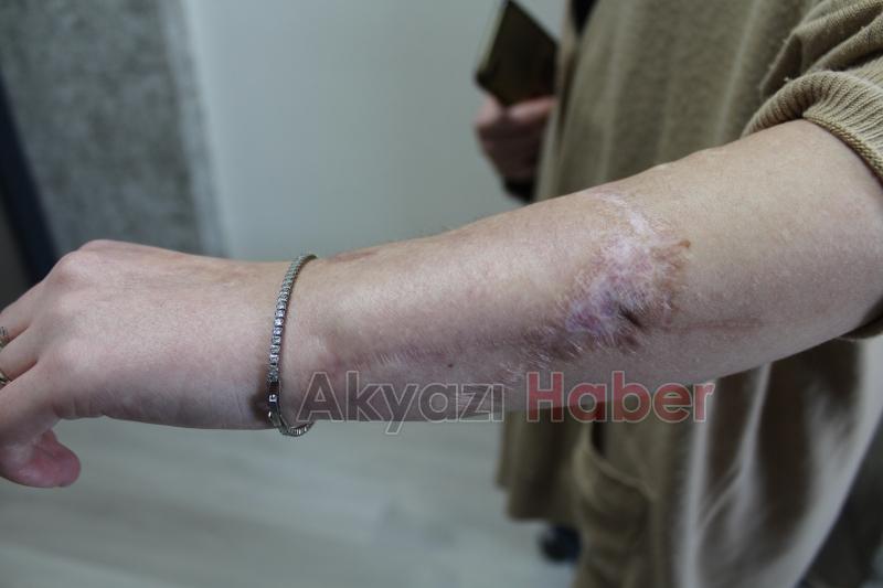 SEAH’ta iki başarılı ameliyatla kopan uzuvlar kurtarıldı