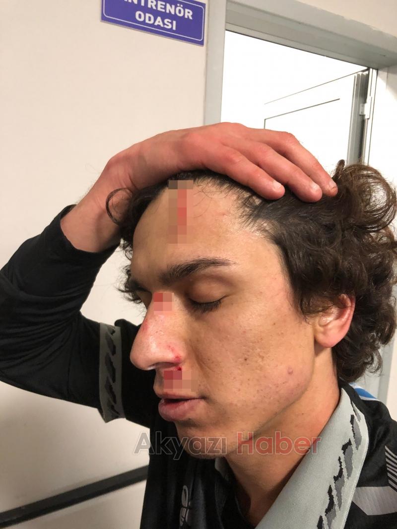 Sakaryasporlu futbolcu gol attı, kanlar içinde kaldı