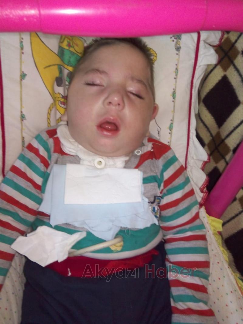 2,5 Yaşındaki Ali İskender Yardım Bekliyor