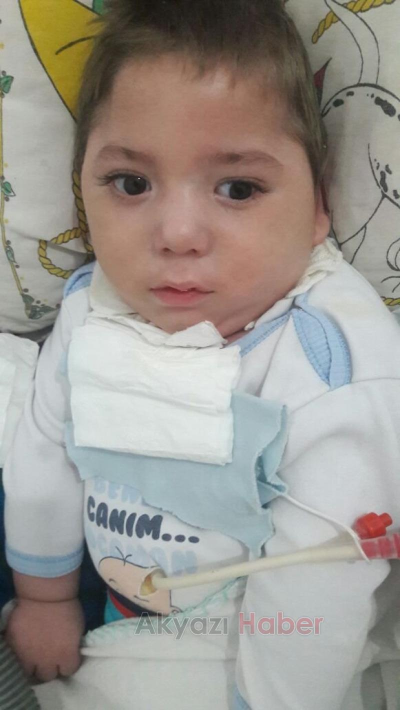 2,5 Yaşındaki Ali İskender Yardım Bekliyor