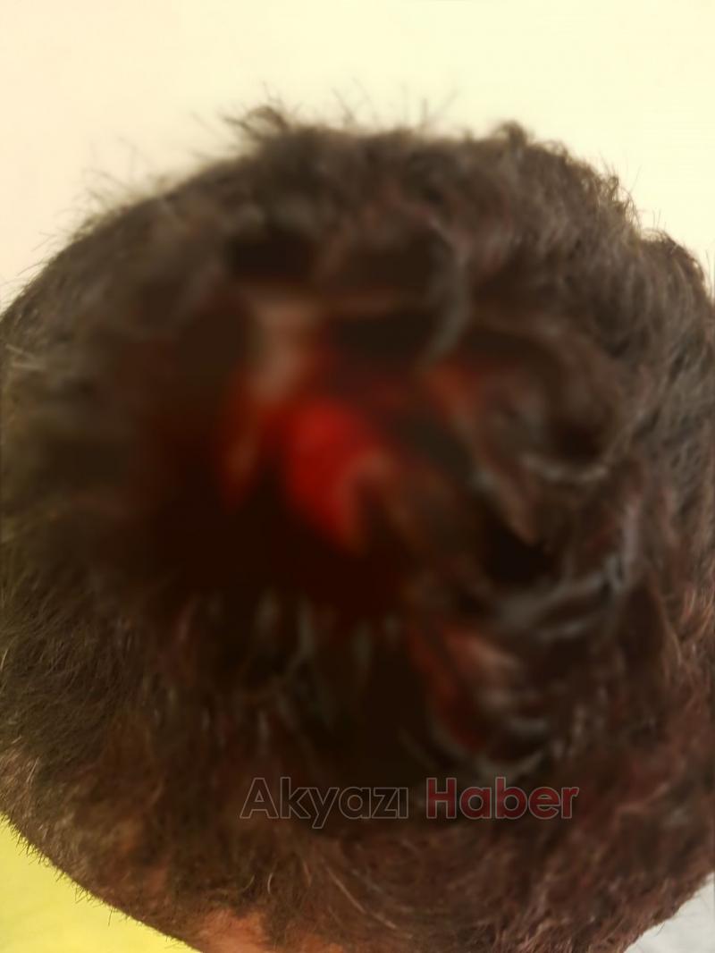 AS AKYAZI MAÇA ÇIKMIYOR 