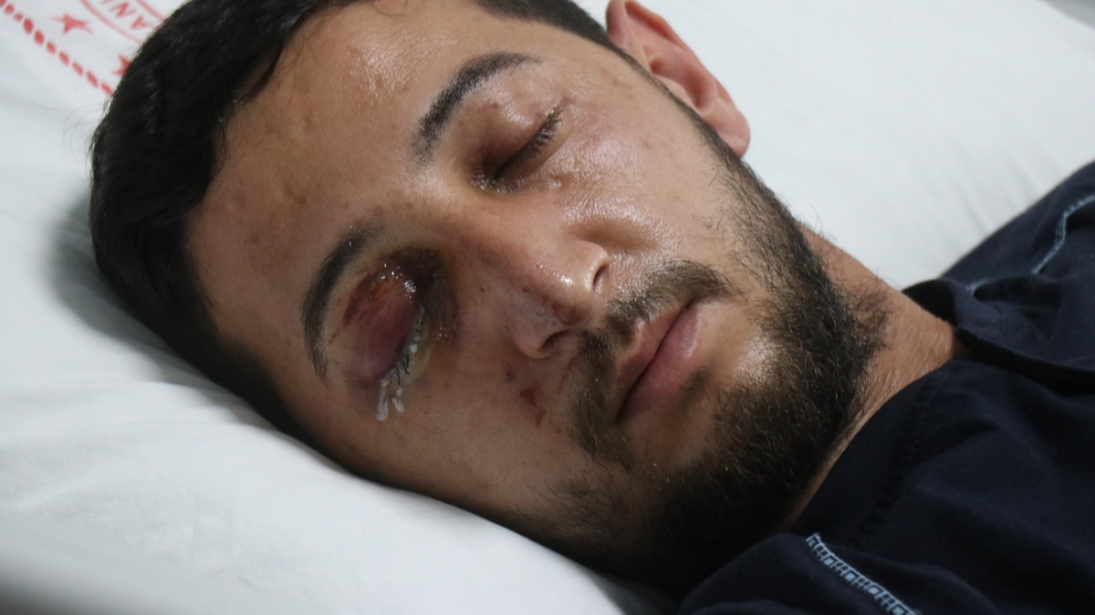 Düğündeki fedakarlığın bedeli ağır oldu