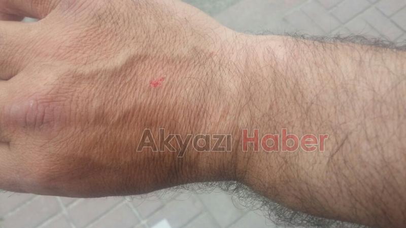 Gazeteciye Çirkin Saldırı