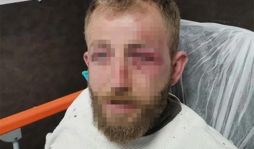 Ormanda dehşeti yaşadı