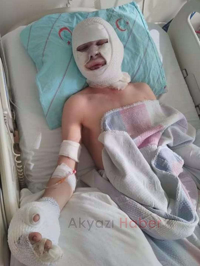 Patlaması Sonrası Yaralı Gençlerin Tedavisi Sürüyor