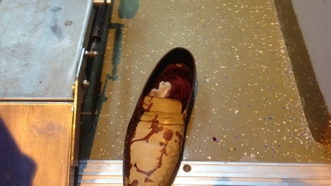 Düğünde Silahla Vurularak Yaralandı