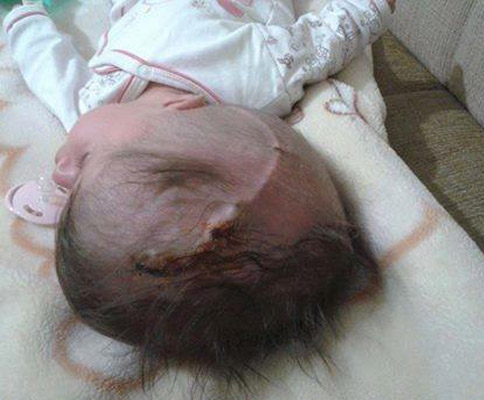 Hidrosefali hastası çocuğun ailesi yardım bekliyor