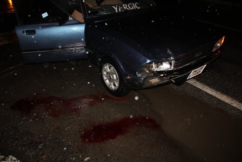 Yaşlı kadına araba çarptı