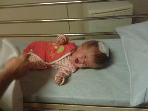  Hidrosefali Hastası Ümmü Gülsüm İçin Ameliyat Parası Toplandı