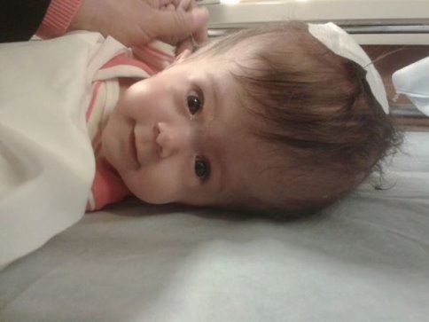  Hidrosefali Hastası Ümmü Gülsüm İçin Ameliyat Parası Toplandı